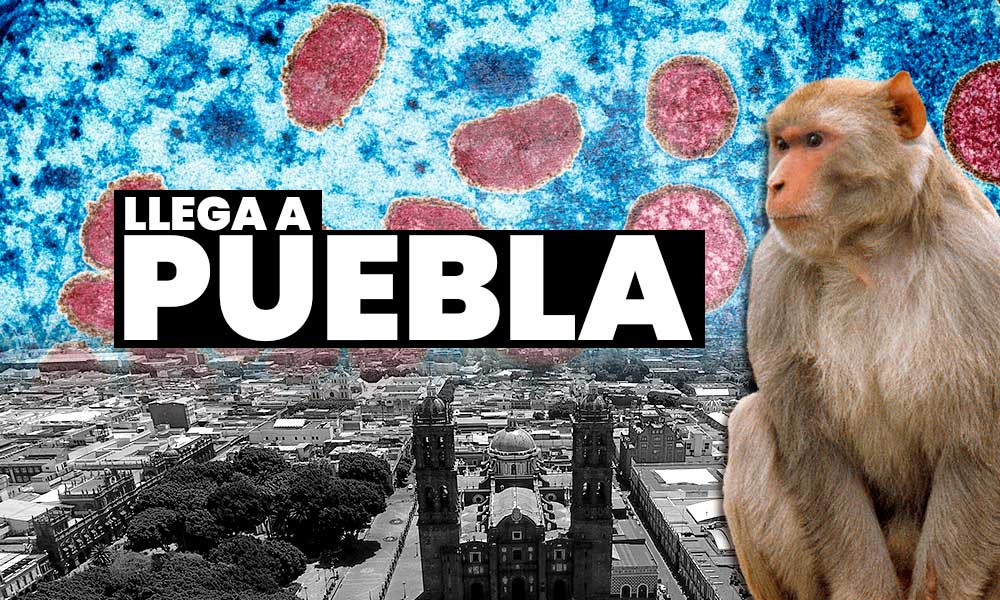 ¡Cuidado! Reportan primeros contagios de viruela del mono en Puebla