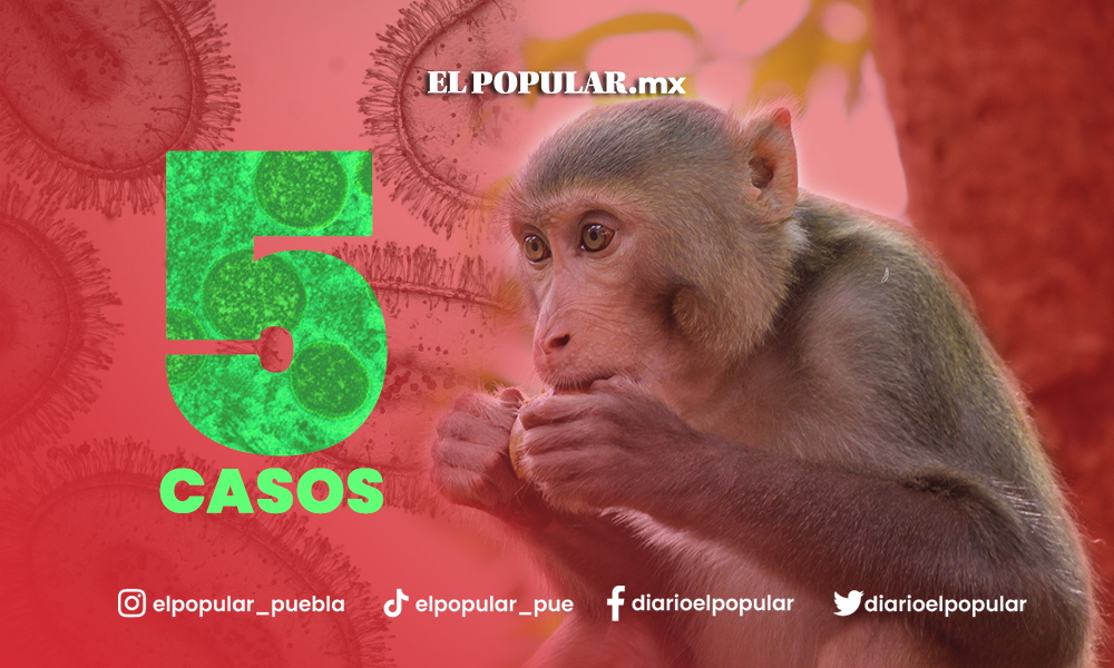 Cinco casos de viruela del mono en Puebla
