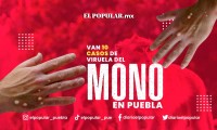 Aumentan casos de viruela símica en Puebla