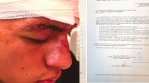 César N, hijo de coordinadora de Comunicación Social del gobierno de Estado es denunciado por agredir a su compañero de futbol