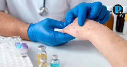 Puebla registra siete casos confirmados de sarampi&oacute;n 