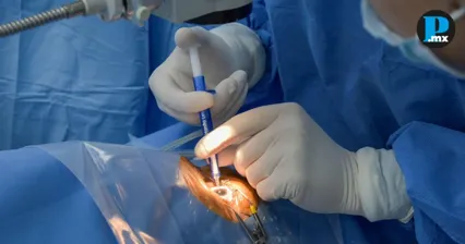 DIF Puebla realiza 109 cirug&iacute;as de cataratas con programa social