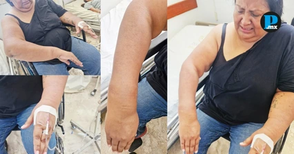 Marlene Paz: detenida y golpeada por polic&iacute;as durante protesta en Acatl&aacute;n