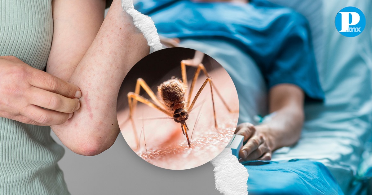 Se reportan 14 casos de dengue en Puebla, secretaría de Salud emite reocimendaciones