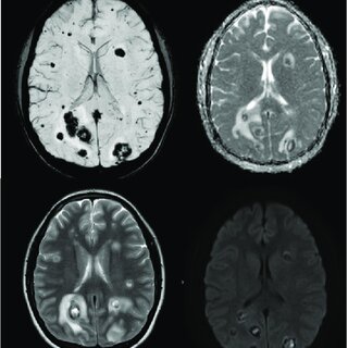 Día del cerebro 22 de Julio.