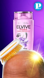 Alertan en redes por shampoo que provoca caída de cabello