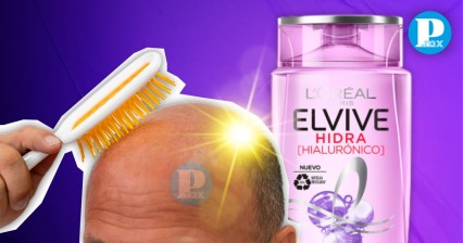 Alertan en redes por shampoo que provoca caída de cabello