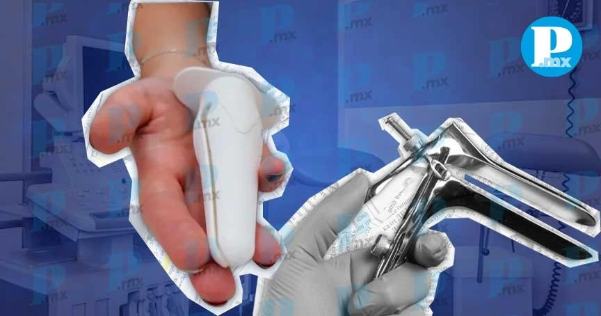 Investigadoras de la Universidad Técnica de Delft, en Países Bajos, diseñaron una versión más amable del espéculo vaginal