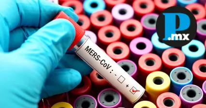 MERS-CoV sigue activo: OMS reporta 19 contagios y 4 muertes en 2025