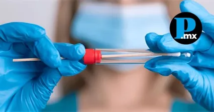 La UNAM desarroll&oacute; una prueba r&aacute;pida para la detecci&oacute;n temprana del Virus del Papiloma Humano.