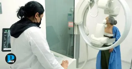 IMSS Puebla realizar&aacute; jornada gratuita de mastograf&iacute;as del 1 al 10 de julio