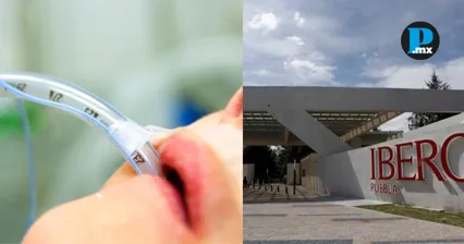 Estudiantes de Ibero Puebla crean dispositivo para reducir lesiones en pacientes intubados