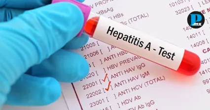 Puebla se ubica en el top 10 nacional por casos de hepatitis A y B