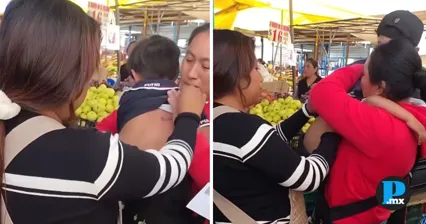 Ni&ntilde;o sufre ataque de perros en mercado de Amozoc