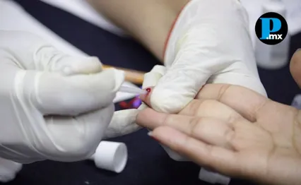 Pruebas gratuitas de VIH, s&iacute;filis y hepatitis C el 14 de octubre en la BUAP