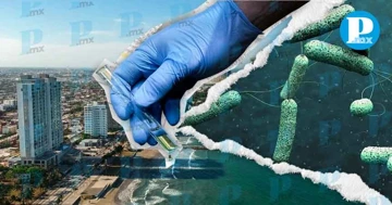 El cólera es una enfermedad infecciosa aguda del intestino delgado, provocada por la bacteria Vibrio cholerae