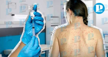 México suma más de 4 mil contagios de sarampión: autoridades piden vacunarse