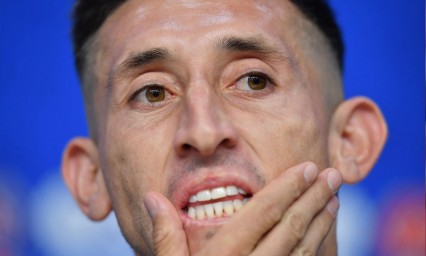 Los memes tras la cirug&iacute;a pl&aacute;stica de H&eacute;ctor Herrera