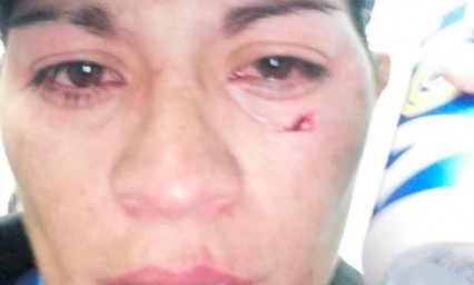 Agreden a mujer arbitro en liga amateur de Puebla 