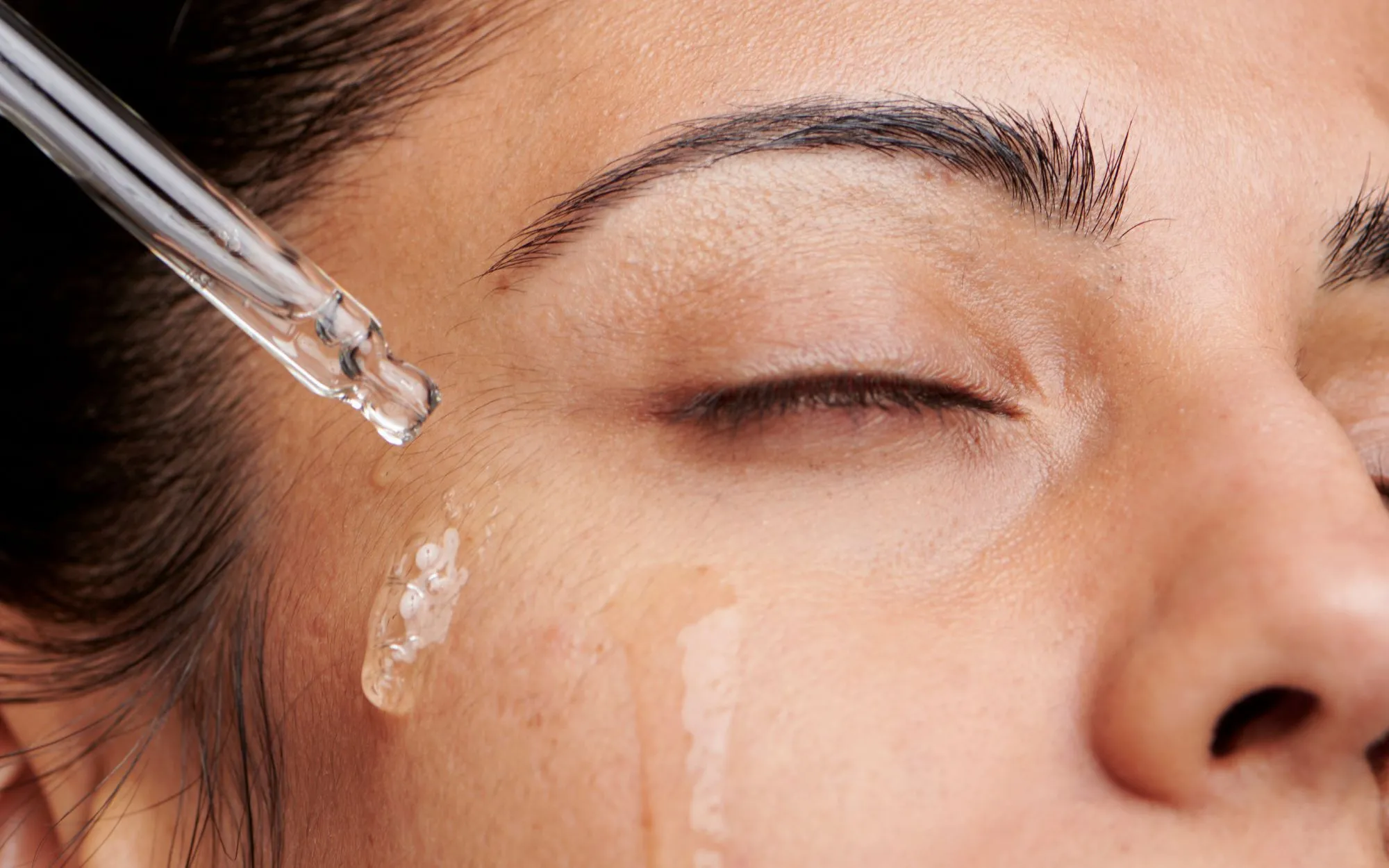 Como usar acido azelaico de forma correcta