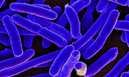 Difunde OMS 12 bacterias que requieren nuevos antibi&oacute;ticos