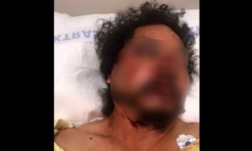 Golpean a mexicano en LA; juntan 80 mil d&oacute;lares para gastos m&eacute;dicos