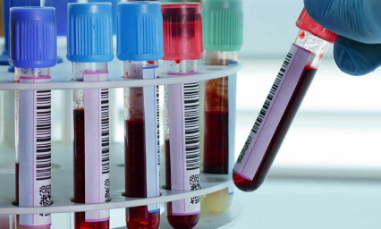 An&aacute;lisis de sangre que te dir&aacute; cu&aacute;nto vivir&aacute;s