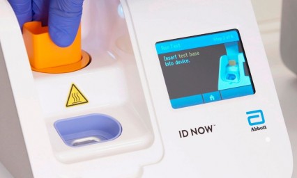 EU aprueba test para coronavirus que funciona en menos de 15 minutos