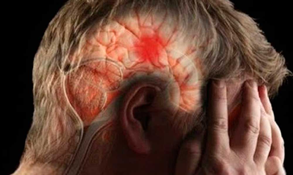 Personas con COVID-19 sufren derrames cerebrales