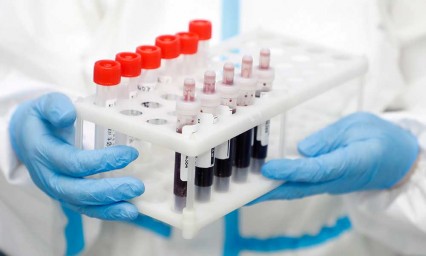 Covid, a punto de matar medio mill&oacute;n en el mundo