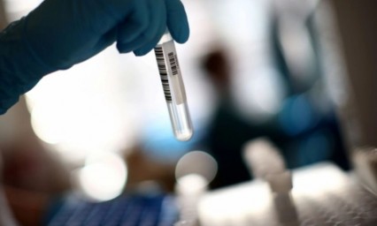 Confirman en EU primer caso de reinfecci&oacute;n por Covid-19