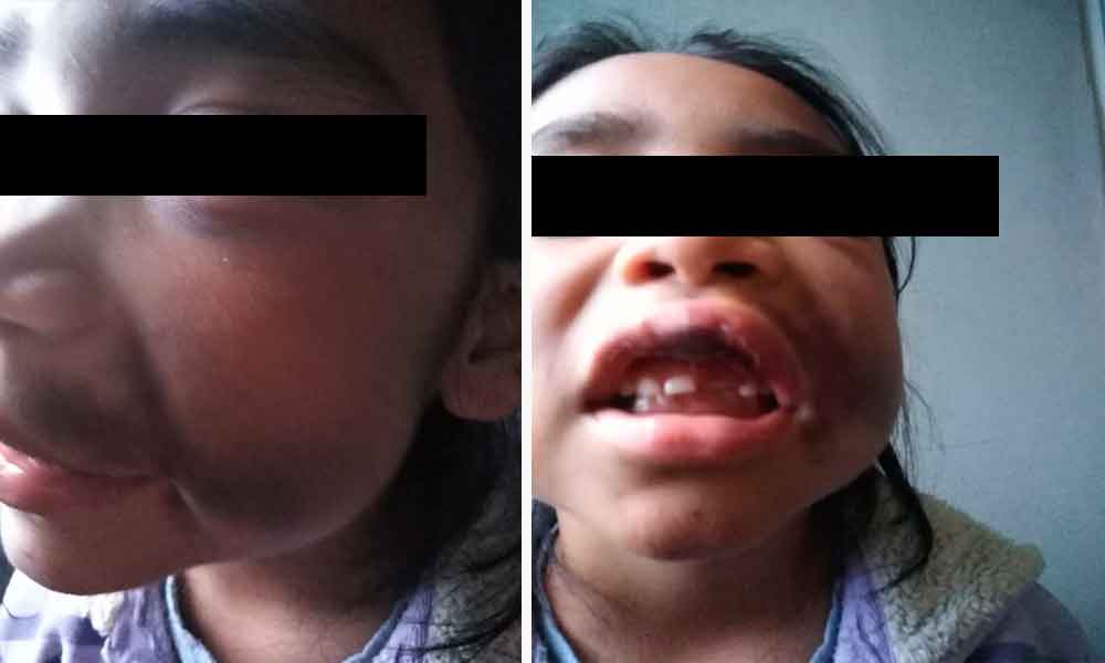 Denuncian golpiza a niña de primaria en Texmelucan 