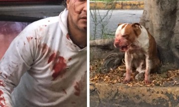 Atlixquense es atacado por Pitbull abandonado