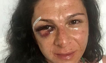 Ordenan prisión preventiva a agresor de Ana Guevara