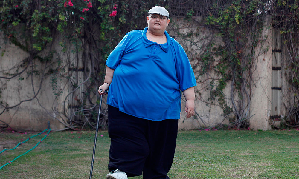 Hombre más gordo de México ya bajó 334 kilos
