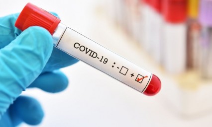 Covid en México: El país rebasa los 652 mil contagios y se acerca a 70 mil muertos