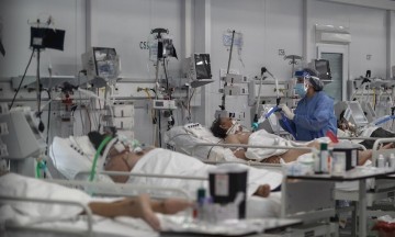 En el país se registran casi 785 muertes por millón de habitantes.