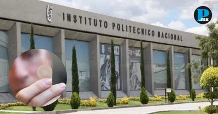 IPN crea parche para pie diab&eacute;tico que ayudar&iacute;a a cicatrizar m&aacute;s r&aacute;pido