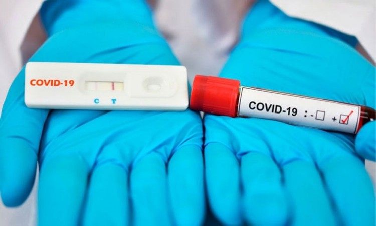 Van contra “pruebas rápidas de Covid-19”