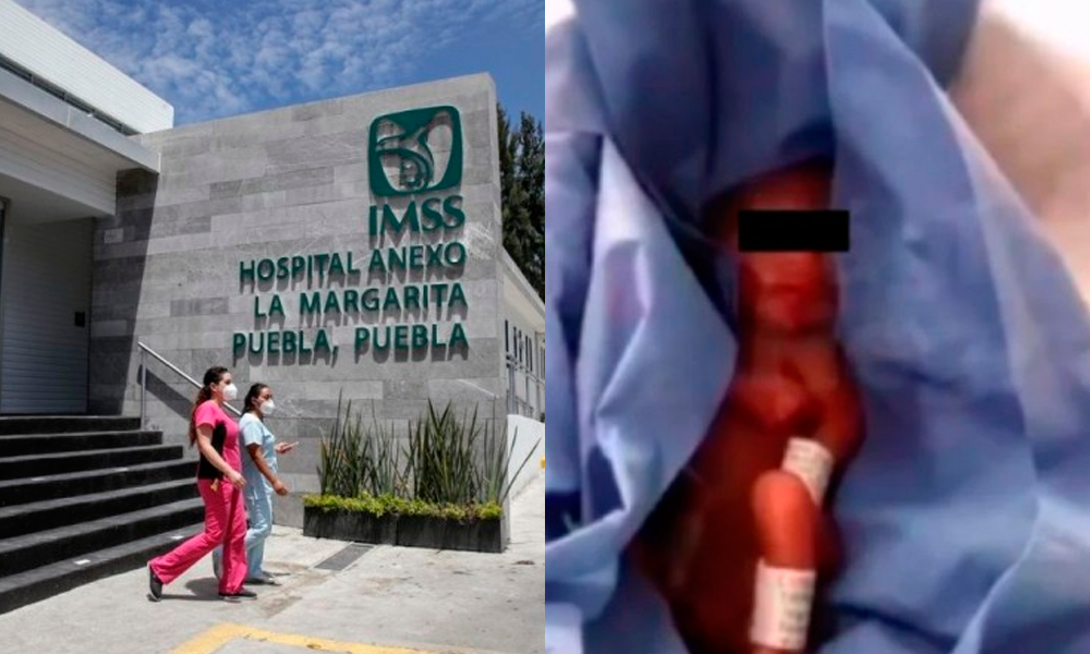 IMMS informa sobre Bebé dado por muerto en La Margarita