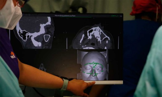 Realizan en el Hospital de Especialidades 5 de mayo exitosas cirugías multidisciplinarias de Alta Especialidad