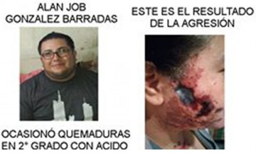 Avienta &aacute;cido al rostro de su pareja porque lo quer&iacute;a cortar