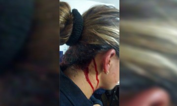 Apedrean a policías por intentar frenar gresca
