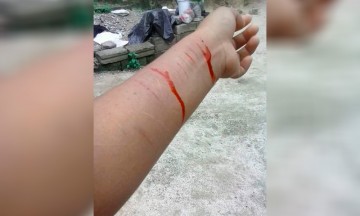 Frustran doble intento de suicidio