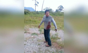 Se resiste asalto y le dan un balazo