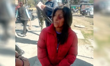 Sufre mujer asalto violento; roban bicicleta y le cortan la cara