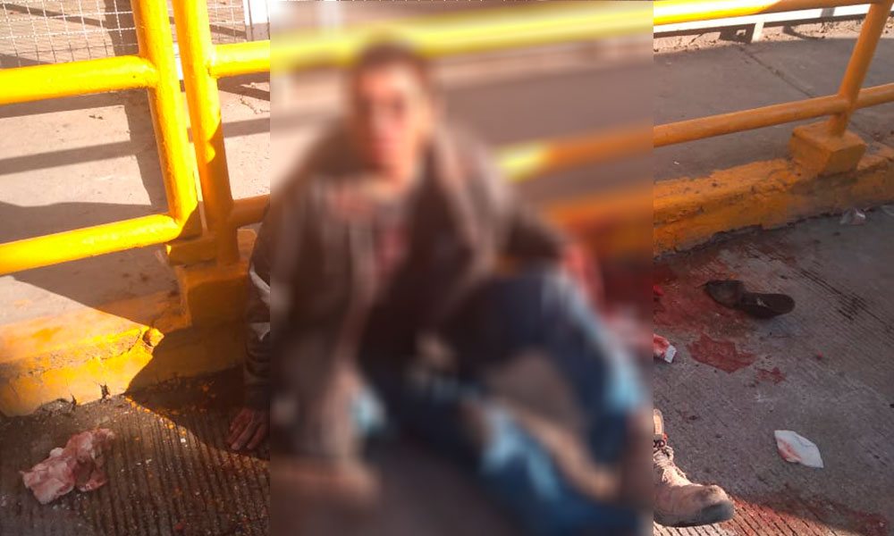 Durante asalto, dejan a hombre golpeado y herido en Xochimehuacan