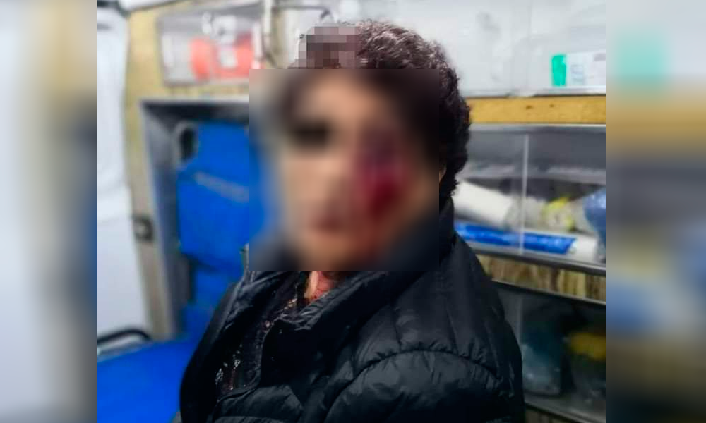 Denuncia mujer de la tercera edad ser golpeada por un policía de Atlixco