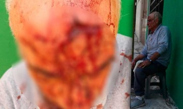 Sujeto golpea a adulto mayor porque le pidi&oacute; no desperdiciar agua