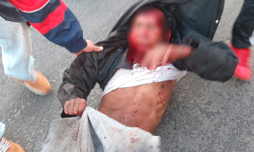 Identifican a asaltante golpeado en Santa María